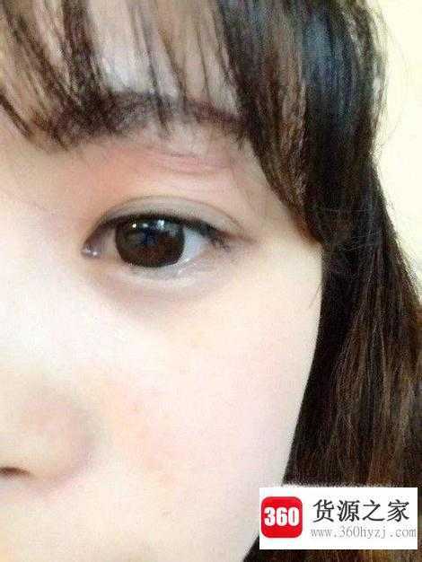怎么让内双变成双眼皮