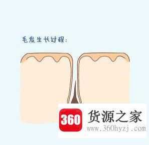 使用家用激光脱毛仪的使用步骤和疗程