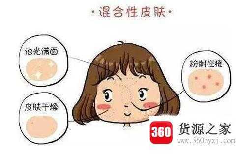 人的皮肤分哪几类？