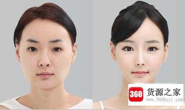 改善下巴后缩的方法