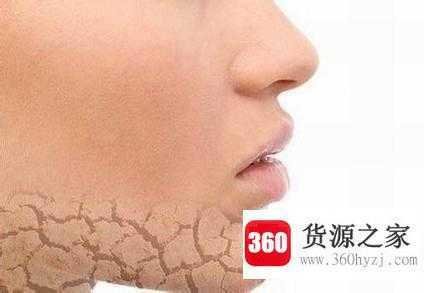 毛孔粗大的原因是什么？