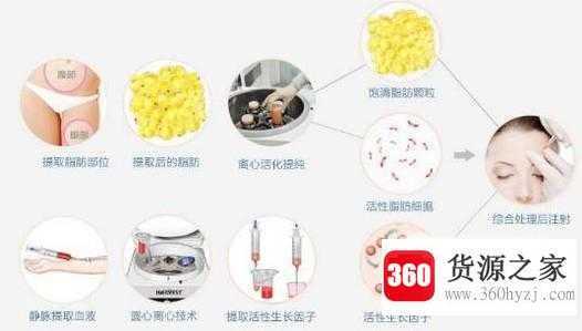 怎么改变太阳穴凹陷？