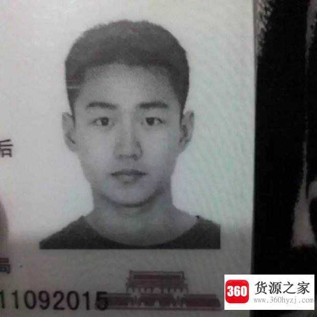 脸部一边大一边小怎么办
