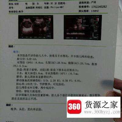 hc是什么意思
