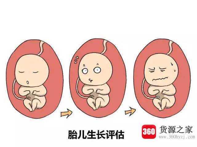 sd是什么意思
