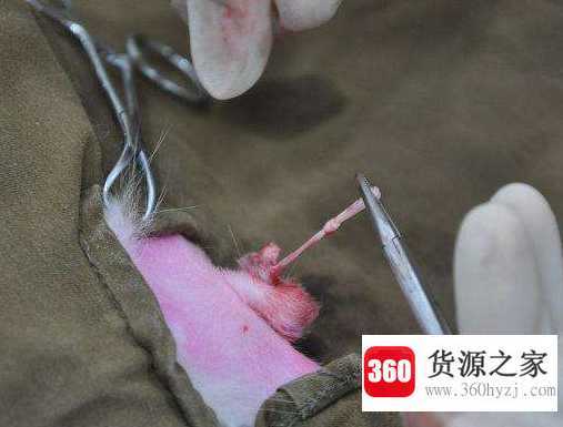 结扎是什么意思