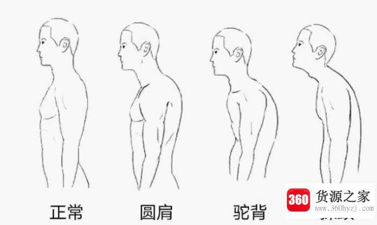 弓背和驼背的区别