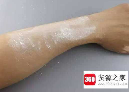 爽身粉的作用有什么
