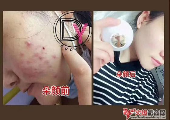 朵颜茜效果怎么样