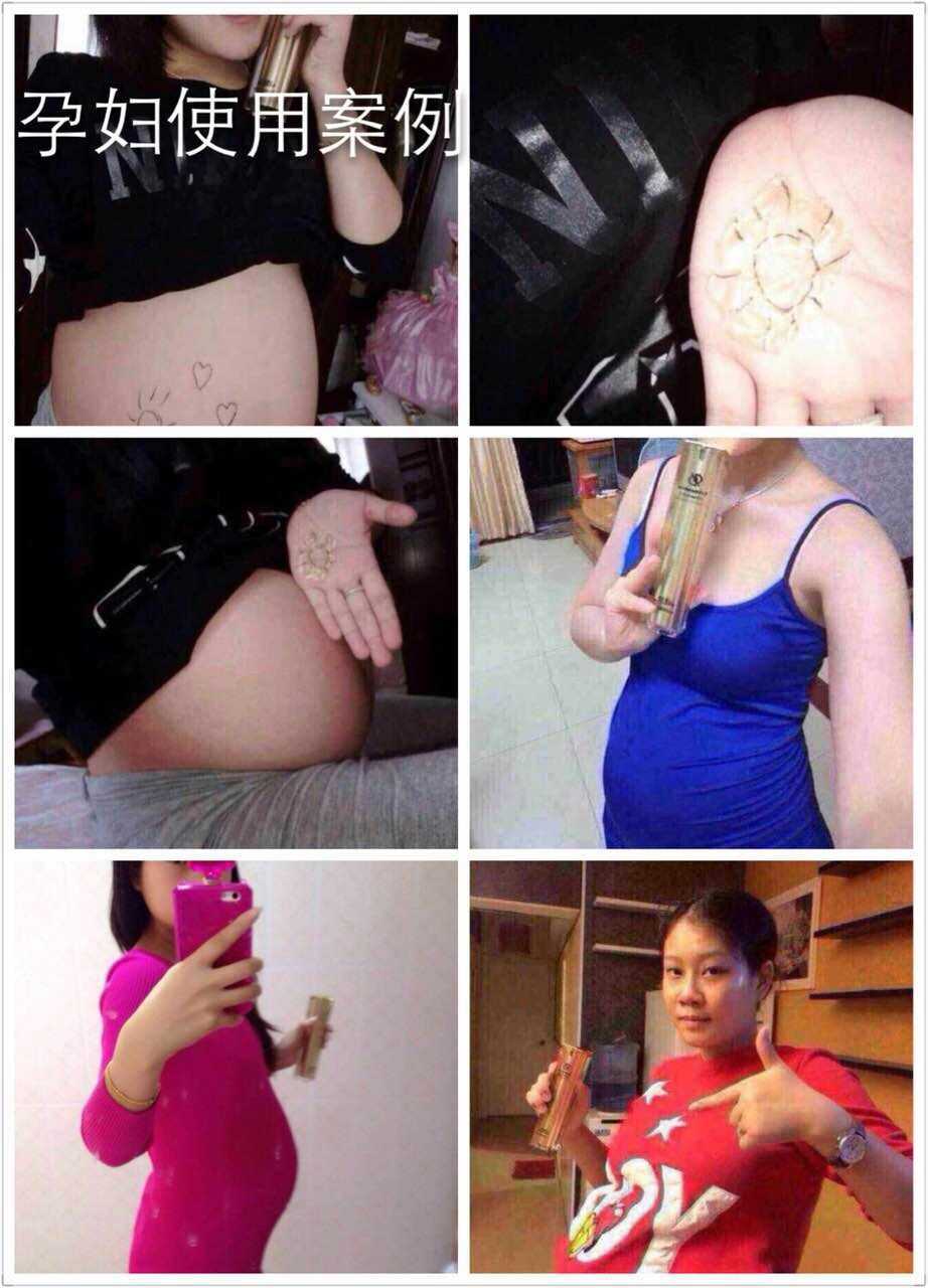 3个微商抬头纹代理货源